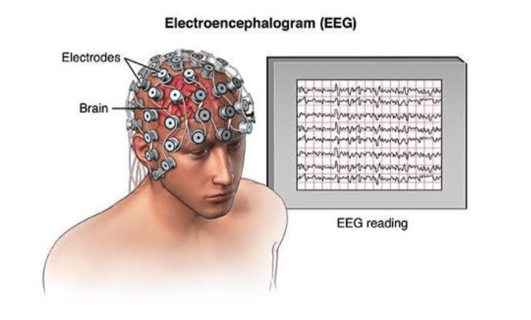 Introduction To Eeg Pdf